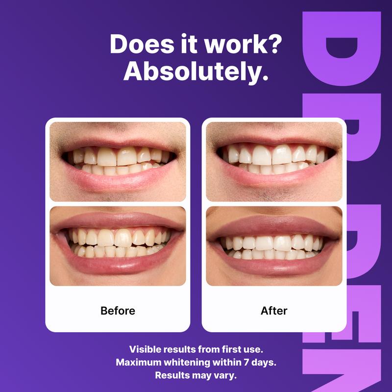 Buy Best Peroxide Free Purple Teeth Whitening Strips enamel safe before and after